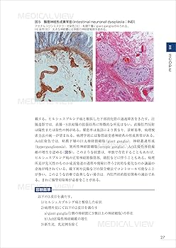 Hirschsprung病類縁疾患―病態解明と診断・治療の研究 [単行本] 英三，岡本; 昭弘，豊坂 Hirschsprung病類縁疾患―病態解明と診断・治療の研究 [単行本